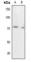 UBA2 Antibody