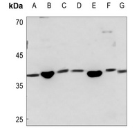 SAE1 Antibody
