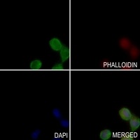 ARP3 Rabbit Polyclonal Antibody