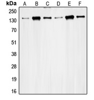 RAD50 Rabbit Polyclonal Antibody