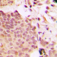 G3BP1 (Phospho-S232) Rabbit Polyclonal Antibody