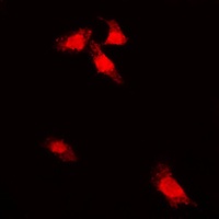 G3BP1 (Phospho-S232) Rabbit Polyclonal Antibody