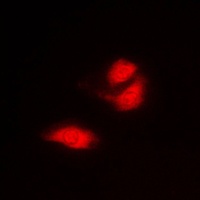 G3BP1 Rabbit Polyclonal Antibody