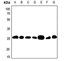BCAS2 Rabbit Polyclonal Antibody