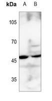 BCKDK Rabbit Polyclonal Antibody