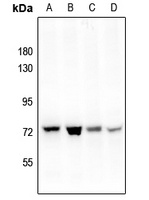 PAK4 (Phospho-S474) Rabbit Polyclonal Antibody