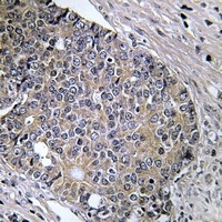 PAK4 (Phospho-S474) Rabbit Polyclonal Antibody