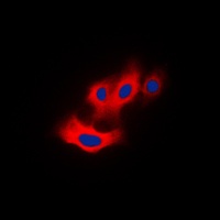 PAK4 (Phospho-S474) Rabbit Polyclonal Antibody