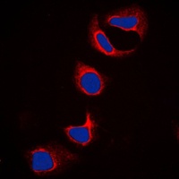 IFITM3 Rabbit Polyclonal Antibody