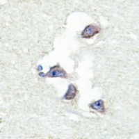 hnRNP Q Antibody