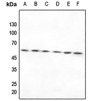 TXNRD2 Rabbit Polyclonal Antibody
