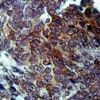FGL2 Rabbit Polyclonal Antibody