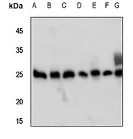 Peroxiredoxin 3 Rabbit Polyclonal Antibody