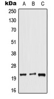 DUSP14 Rabbit Polyclonal Antibody