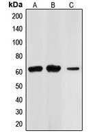 CHK2 Rabbit Polyclonal Antibody