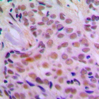 CHK2 Rabbit Polyclonal Antibody