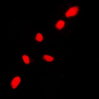 CHK2 Rabbit Polyclonal Antibody