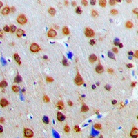 AKAP13 Rabbit Polyclonal Antibody