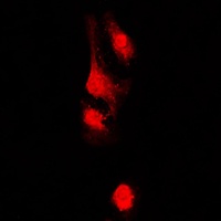 AKAP13 Rabbit Polyclonal Antibody