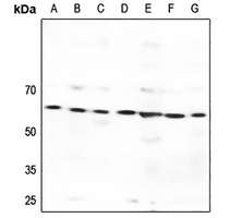 GPR176 Rabbit Polyclonal Antibody