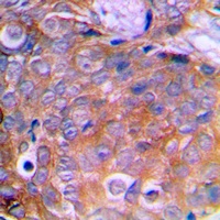 Cortactin Rabbit Polyclonal Antibody