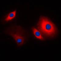 Cortactin Rabbit Polyclonal Antibody