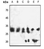 EB3 Antibody
