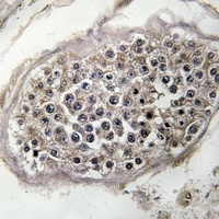 RAB3GAP1 Antibody