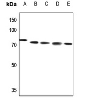 ABCB10 Rabbit Polyclonal Antibody