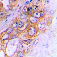 ABCB10 Rabbit Polyclonal Antibody