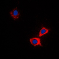 ABCB10 Rabbit Polyclonal Antibody