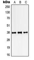 SSBP2 Rabbit Polyclonal Antibody