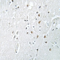 SSBP2 Rabbit Polyclonal Antibody