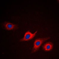 Apolipoprotein L2 Rabbit Polyclonal Antibody