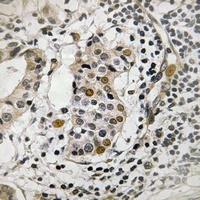 HBP1 (Phospho-S402) Rabbit Polyclonal Antibody