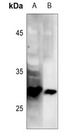LAT (Phospho-Y191) Rabbit Polyclonal Antibody