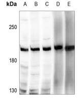 ZNF638 Rabbit Polyclonal Antibody