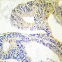 ZNF638 Rabbit Polyclonal Antibody