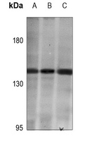 HIPK2 Rabbit Polyclonal Antibody