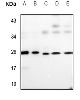 UBE2T Antibody [KO/KD Validated]