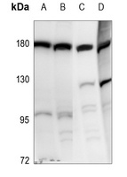 DROSHA Rabbit Polyclonal Antibody