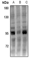 UHRF1 Rabbit Polyclonal Antibody