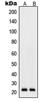 RhoD Rabbit Polyclonal Antibody