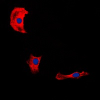 Fibulin 4 Antibody