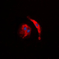 Collagen 5 alpha 3 Antibody