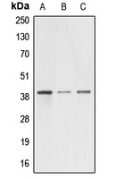 A4GNT Rabbit Polyclonal Antibody