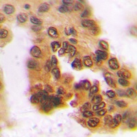 A4GNT Rabbit Polyclonal Antibody
