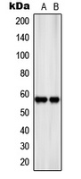 SLC22A17 Rabbit Polyclonal Antibody
