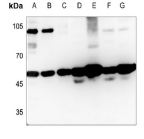MAGEC2 Antibody