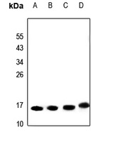 SAP14 Rabbit Polyclonal Antibody